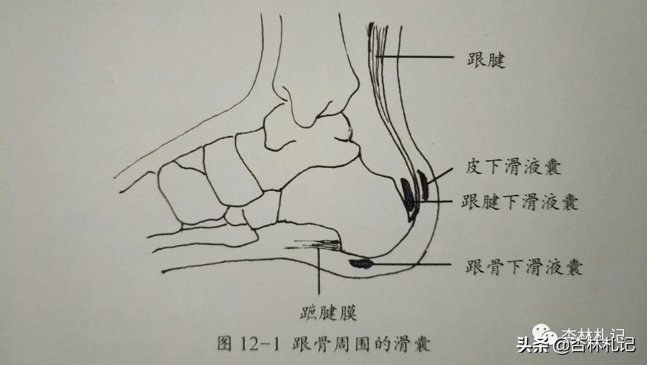 趾腱筋膜炎的位置图片图片