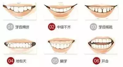 一个牙套而已,凭什么那么贵?
