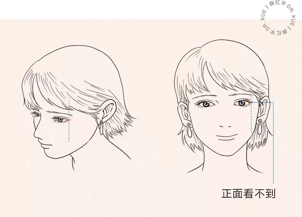 要不要开外眼角？要不要做眼睑下至？