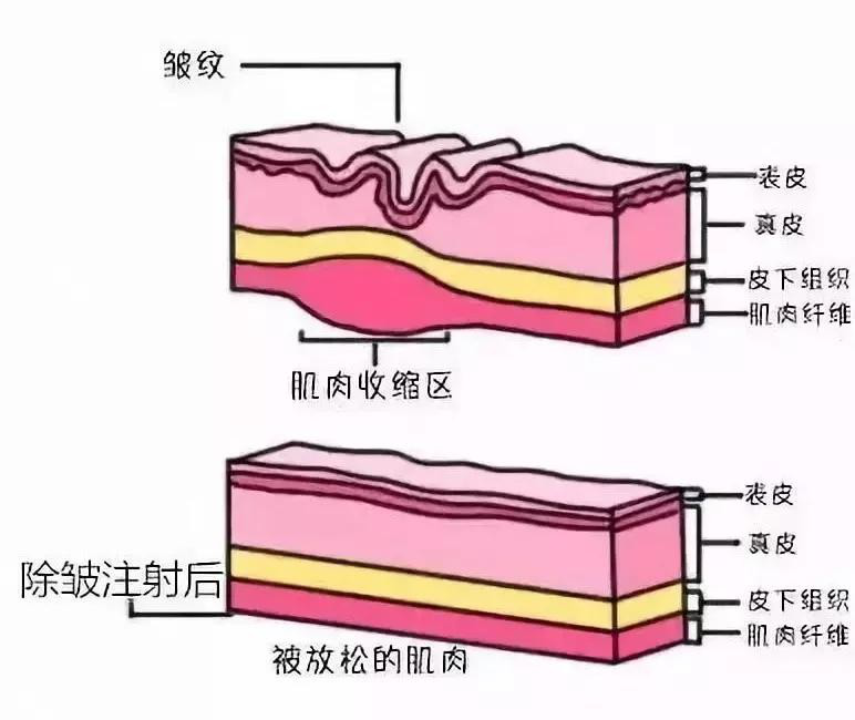 鱼尾纹、抬头纹、法令纹，人生进阶时刻，你真的没“纹”题吗