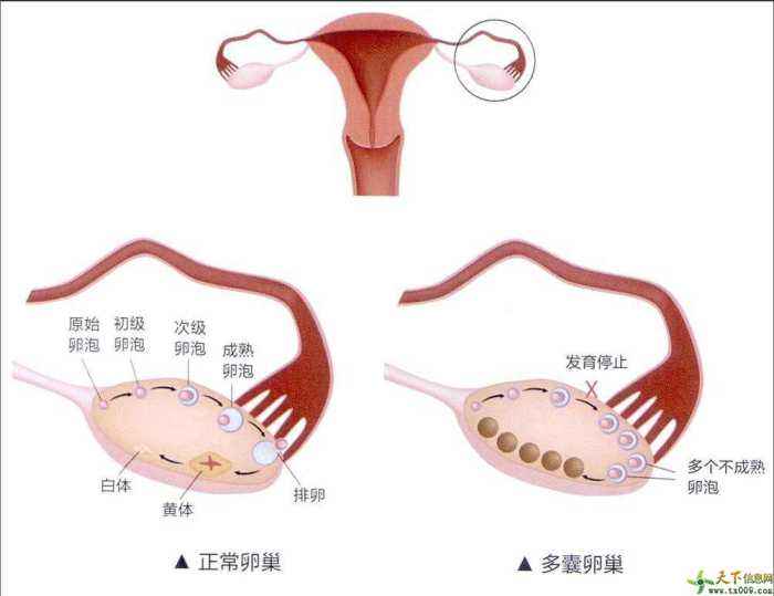 化验性激素六项有什么用？教您在家看懂性激素六项化验单