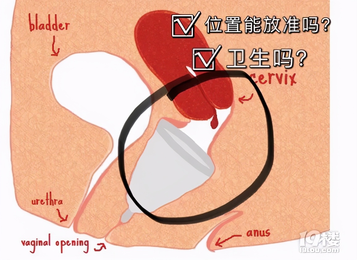 刷新三观！塞进体内的“月经杯”，感觉不可描述