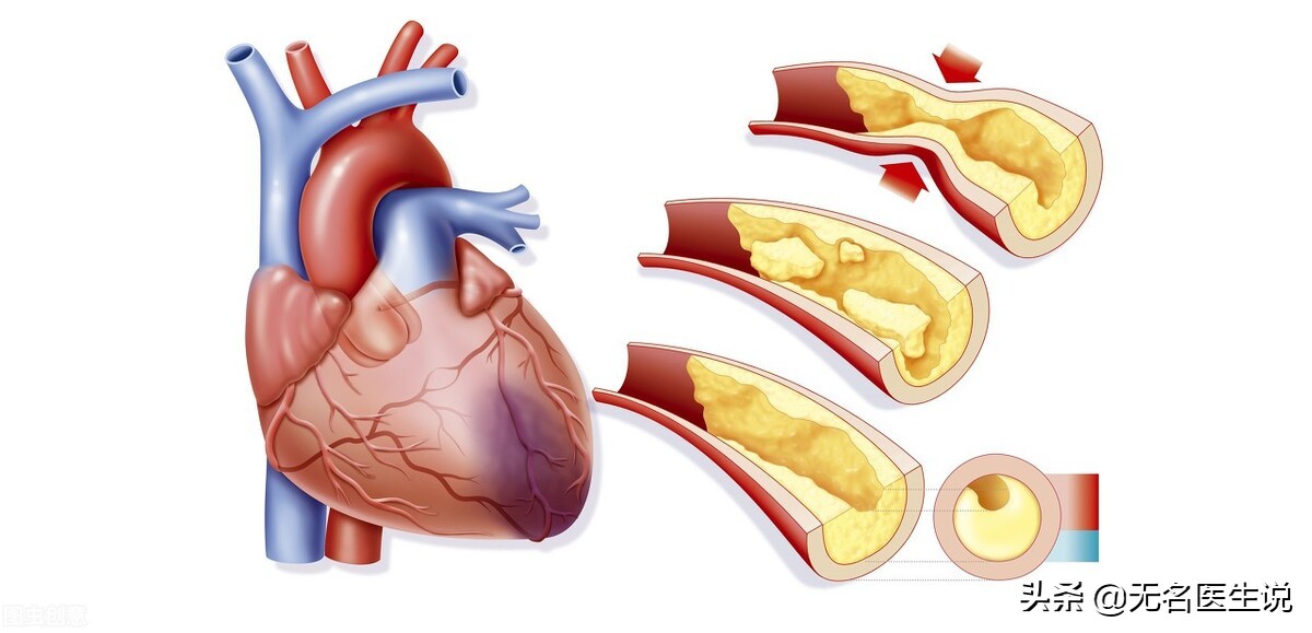 冠心病的解剖基礎——最全的冠脈血管圖解