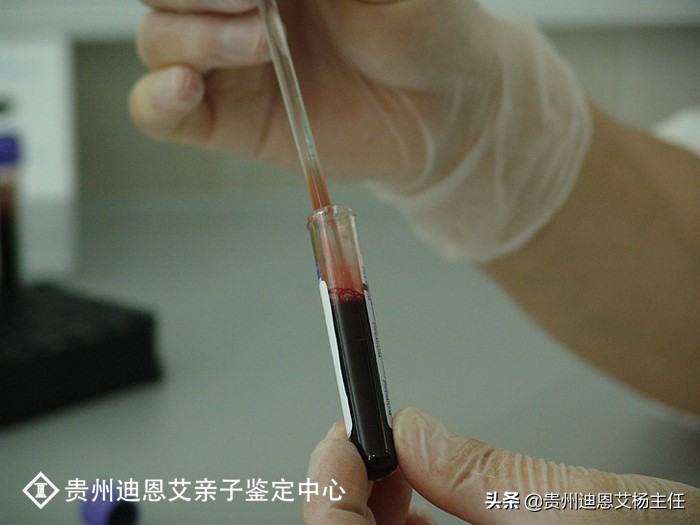 亲子鉴定流程,亲子鉴定流程详细步骤