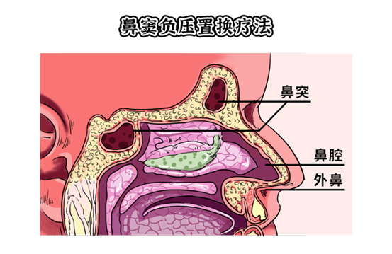 “裤子脱掉，趴上去！”盘点医院里让人脸红的检查，太刺激了