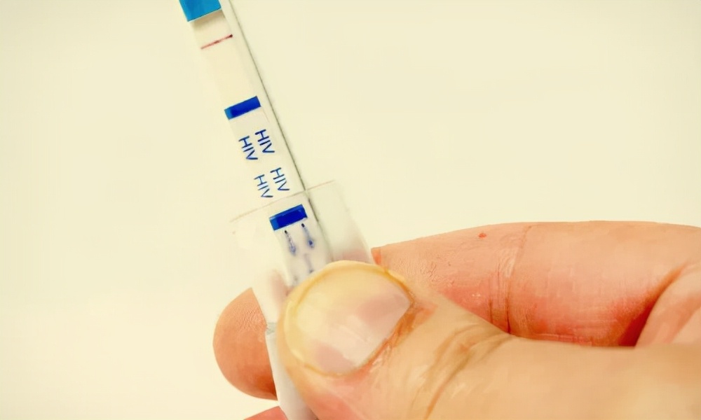 为什么“男同”更容易患HIV？