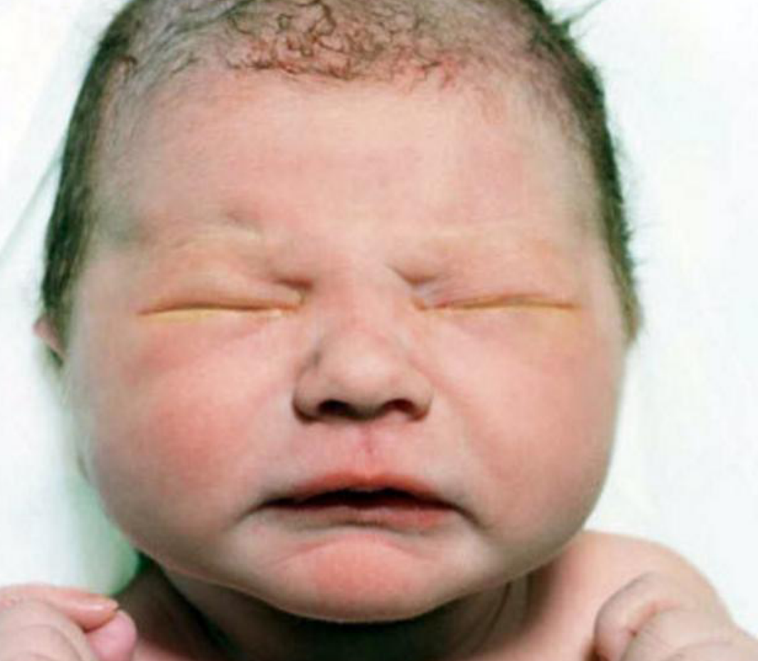大家能晒一晒你们的宝宝婴儿时期的「丑照」吗？ - 知乎