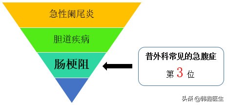 肠梗阻的诊断和治疗