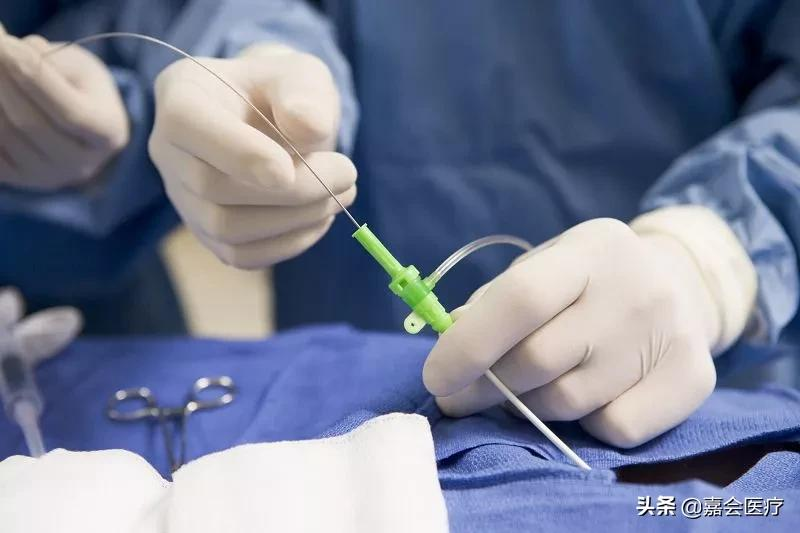 输卵管“堵”了怎么办?生殖科医生详解治疗方法