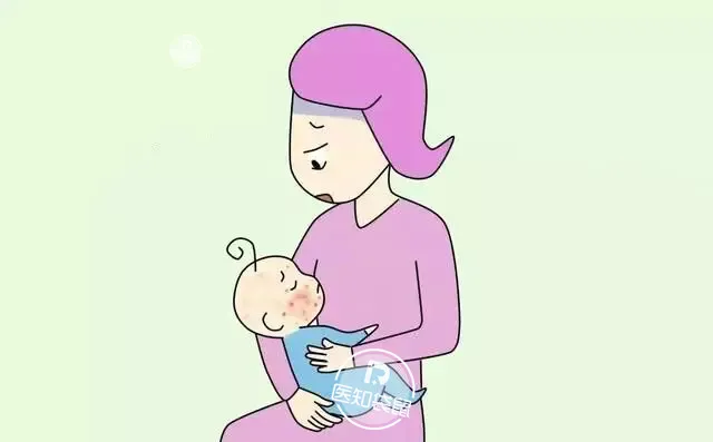 湿疹、黄疸折磨宝宝？妈妈这样做，宝宝少遭罪
