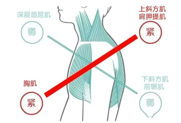 鞠婧祎最真实生图流出，山根粗壮被嘲水泥柱，有没有整容一目了然