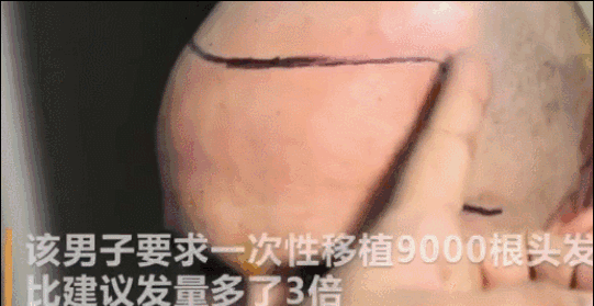 把杨幂顶上热搜、把富豪搞没命…“发际线”你可真牛昂