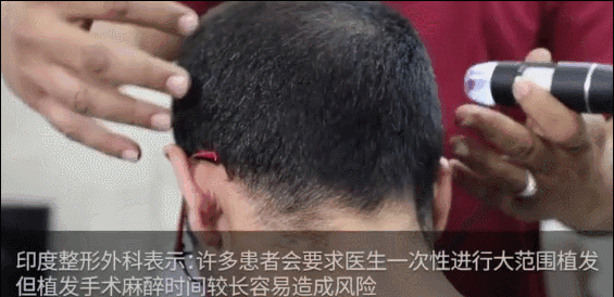把杨幂顶上热搜、把富豪搞没命…“发际线”你可真牛昂