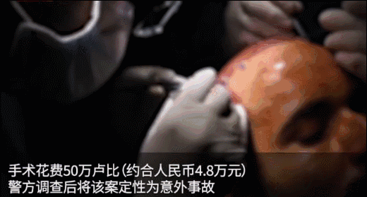 把杨幂顶上热搜、把富豪搞没命…“发际线”你可真牛昂