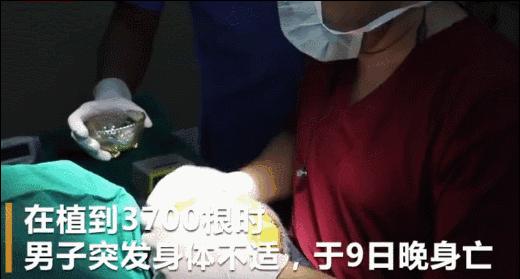 把杨幂顶上热搜、把富豪搞没命…“发际线”你可真牛昂