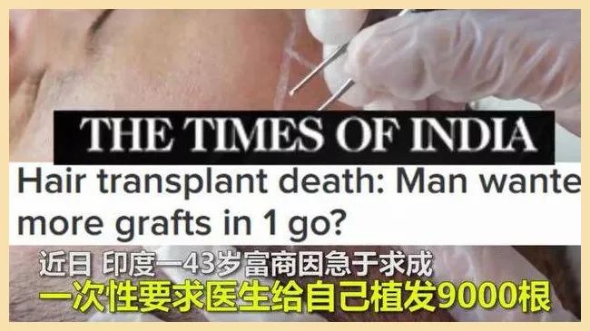 把杨幂顶上热搜、把富豪搞没命…“发际线”你可真牛昂
