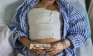 和老公女儿出国度假前查出乳腺癌，最后一次化疗想为自己买墓地……杭州35岁乳腺癌患者的康复笔记