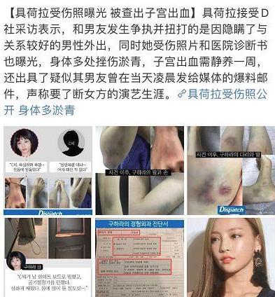 具荷拉事件是什么详细始末曝光 具荷拉事件全过程完整回顾