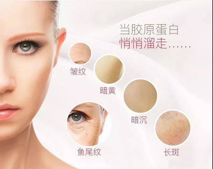 2020想要年轻貌美回家过年，线雕是明智的选择