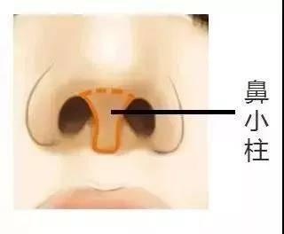 隆鼻术的术后需要注意什么？假体隆鼻可以一辈子吗？