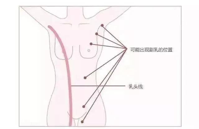 吊带衫、连衣裙因为它不敢穿？副乳到底是啥？出现了应该怎么办？