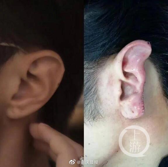 上海“时尚大V”见义勇为被咬耳案开庭，被告人称“喝断片”咬的是男是女都记不清