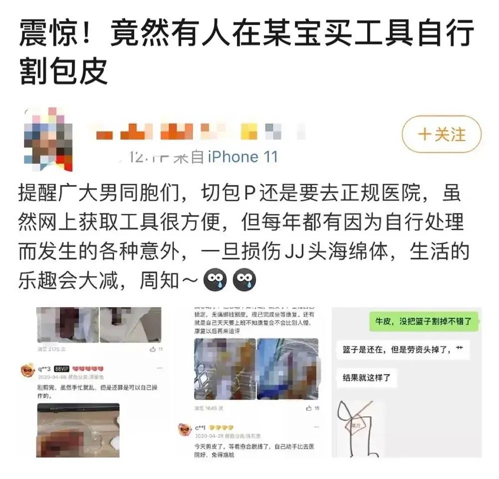 我的小老弟，下次割包皮别用UC浏览器搜医院了