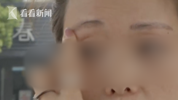 花6万纹“风水眉”结果成了两把“大刀”？女子崩溃：不敢去上班