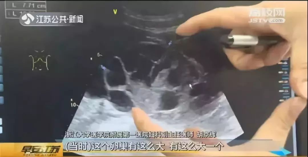 学校厕所里竟有这样的广告！女同学怒怼