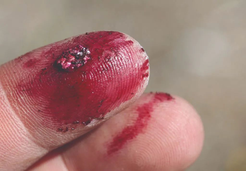 影视剧里的流血伤口是怎么来的?