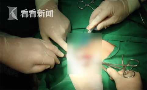 救人要紧！输液到一半 他突然拔掉针管冲了出去