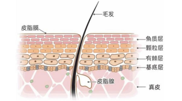 婴儿腹股沟破皮抹什么（痱子痒）