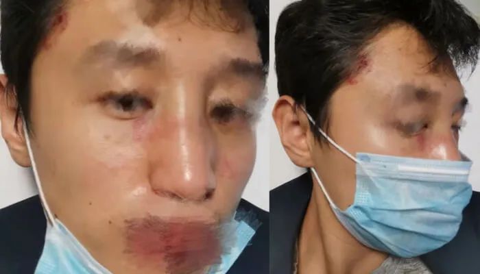 补壹刀：中国学霸在英遭疯狂袭击，背后有蹊跷