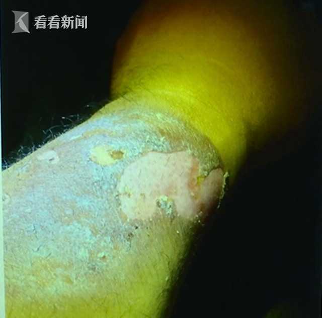 7名家属受伤！迎亲路头车急刹6辆婚车连环追尾，责任谁来担？