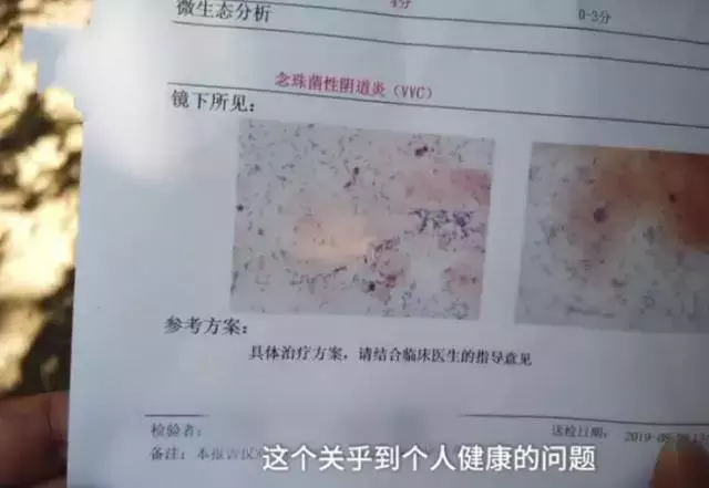 假避孕套,假避孕套的危害有多大!