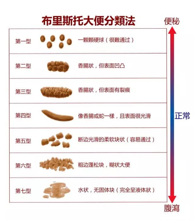 绿便、泡沫、水便分离…宝宝每天拉的大便，藏着身体好坏的信号