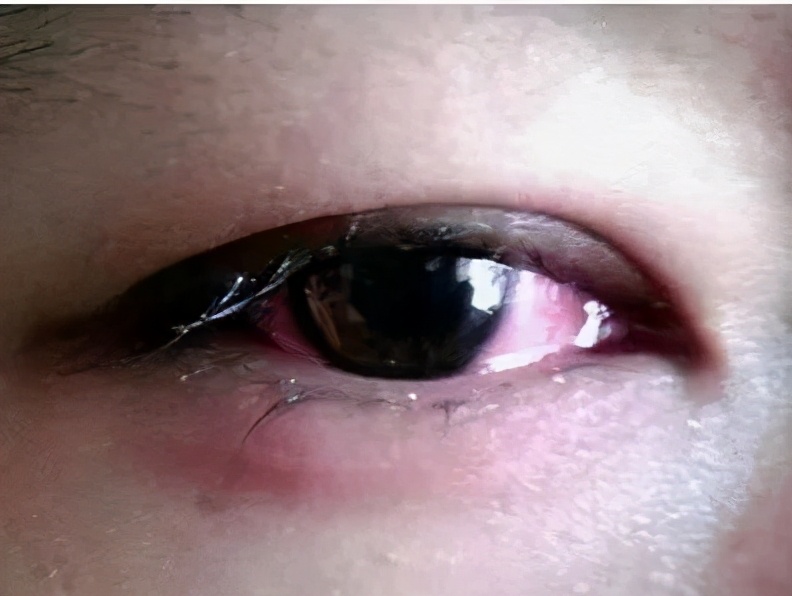 别再这样戴美瞳了,会瞎的