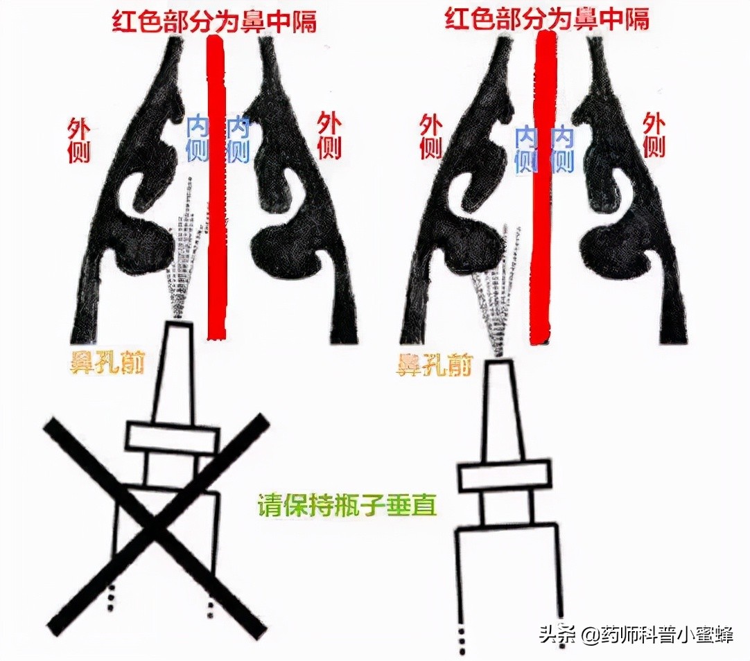 6.鼻喷雾剂这样用效果好，还能避免鼻出血