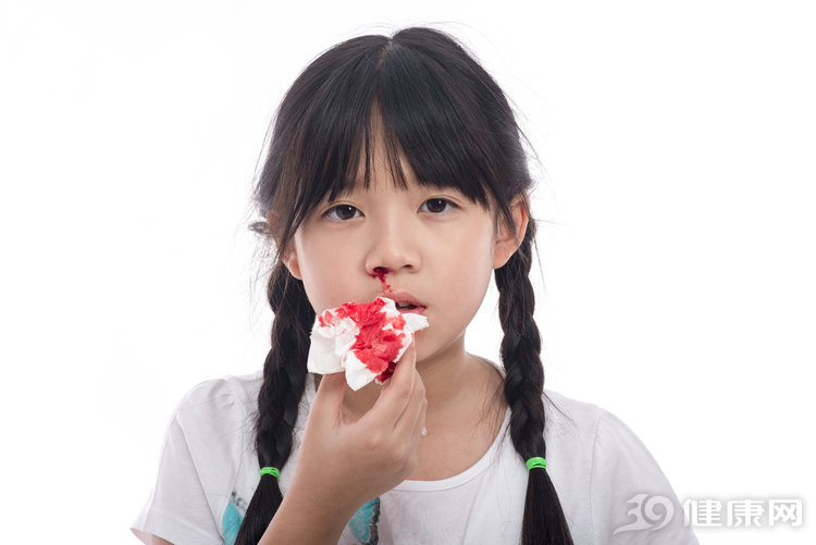 鼻出血是怎么回事？可能与这3个因素有关，不可小看