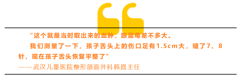 1岁男童摔倒后舌头上竟然惊现“寄生虫”！