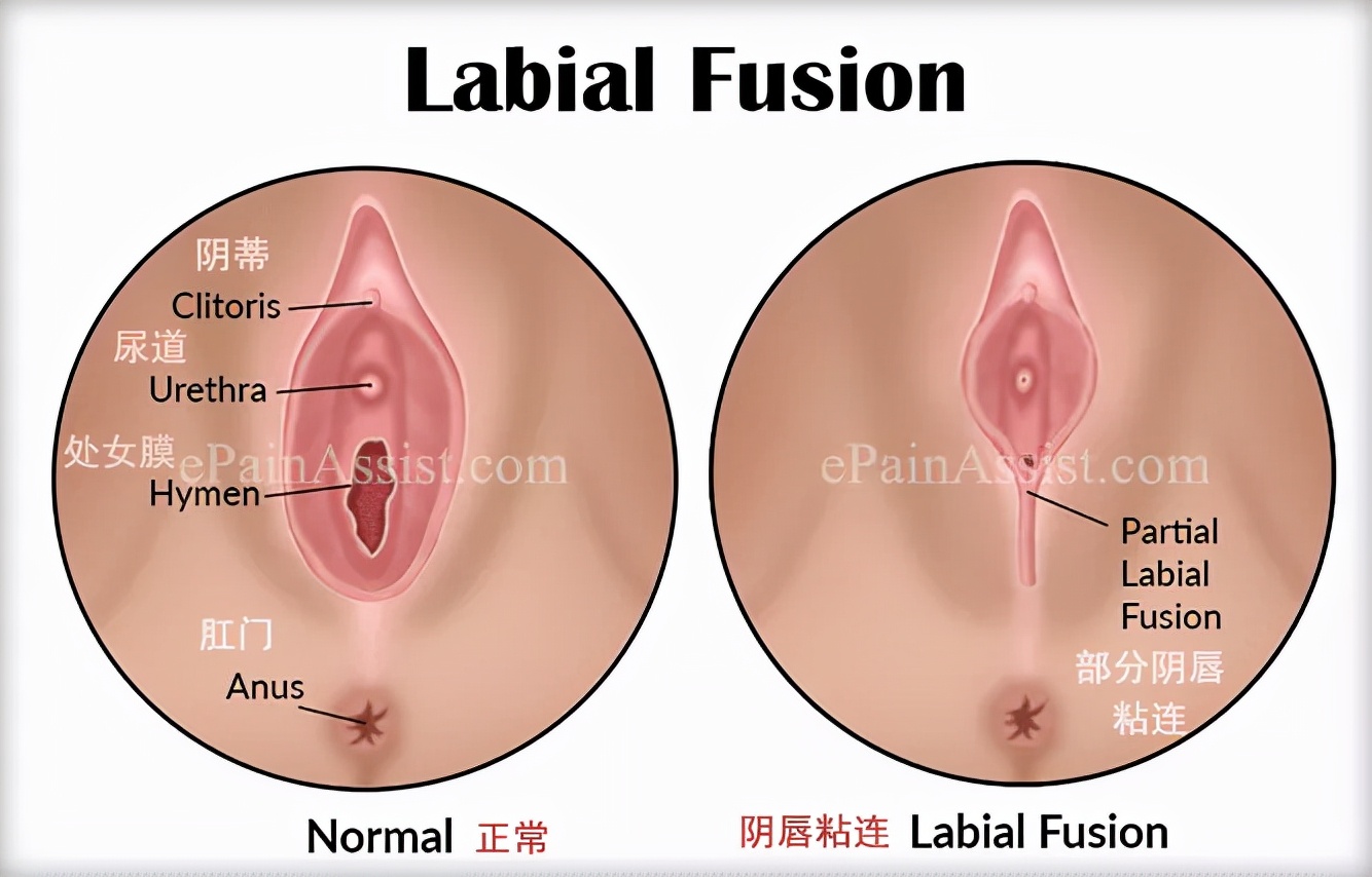 清洗宝宝私处，千万别做这4件事！（男女宝都有）