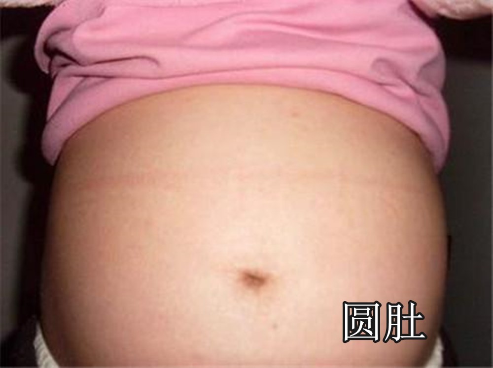 孕肚“倒梯形”生女孩？孕肚“横竖”两条线和形状，都和性别无关