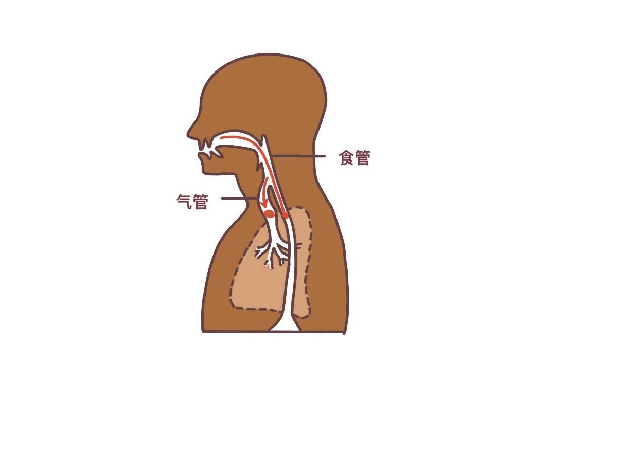 关键时刻能救命，针对不同人群的海姆立克急救方法，超详细图解