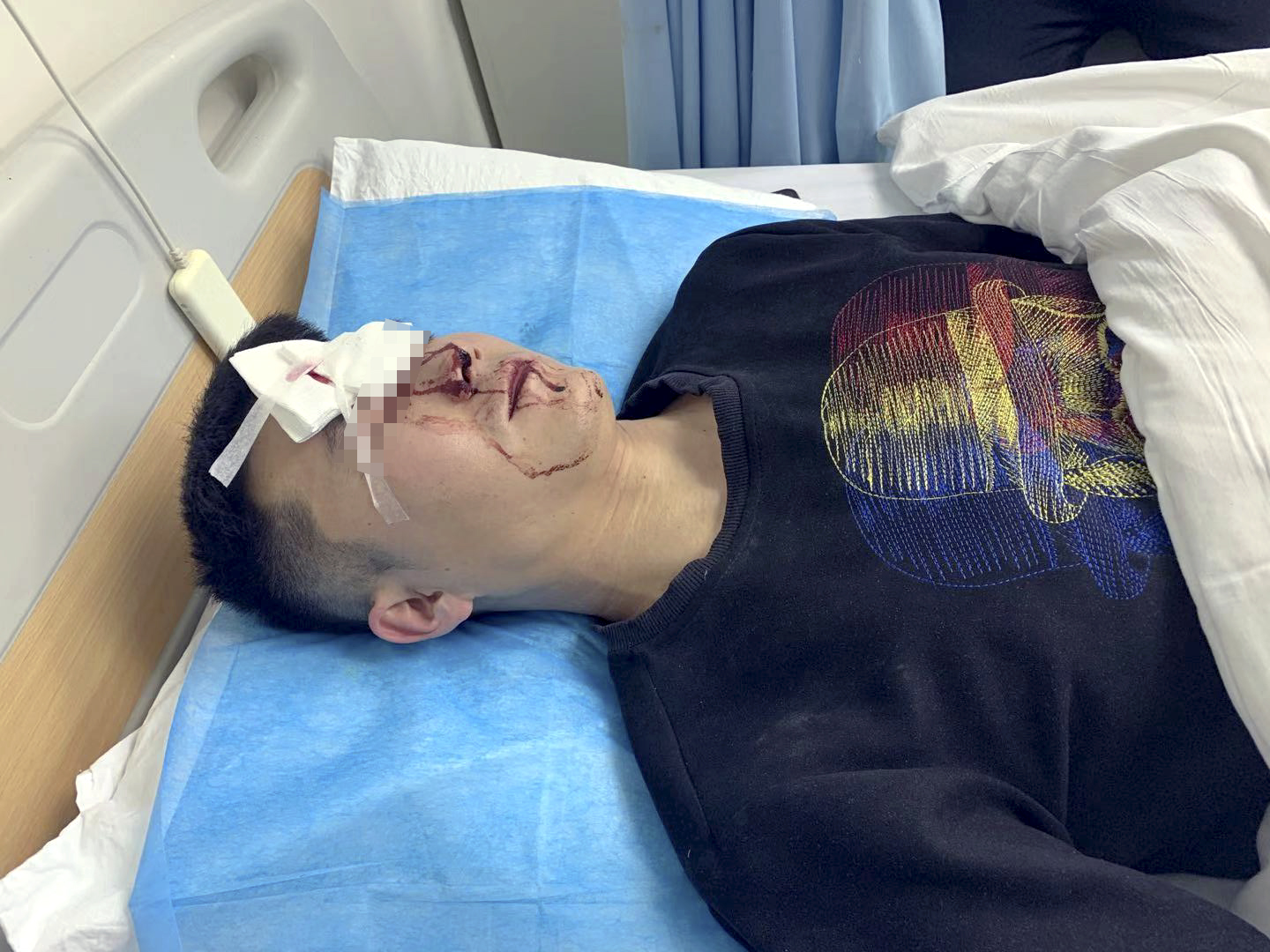 做验房师8年头一次遭袭头部缝6针，验房师并非专挑别人毛病，3名打人男子被行政拘留