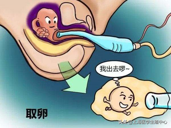 在试管助孕治疗中，女性需要承受什么？