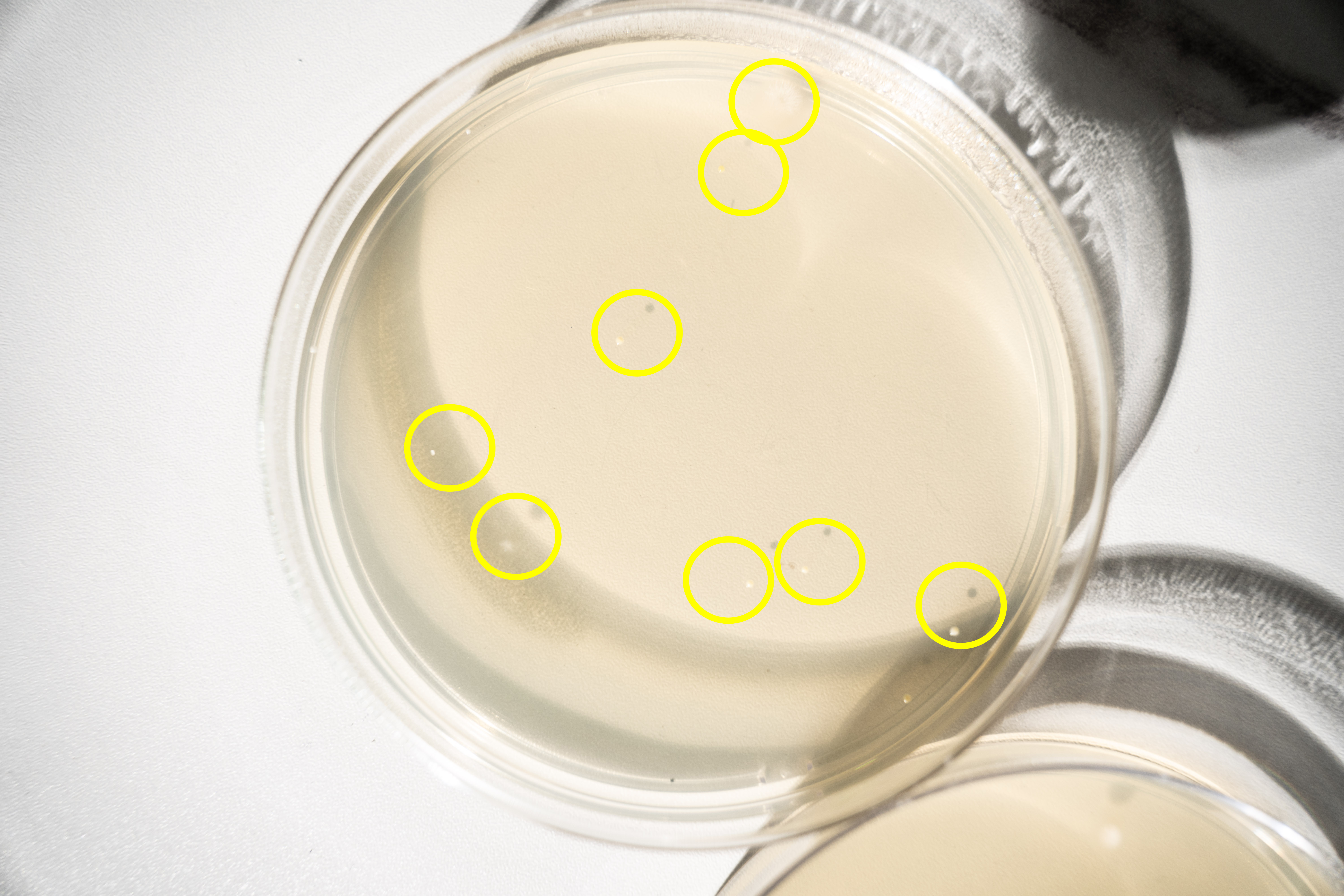 经过两天等待,培养皿已经出结果,最近气温低所以细菌繁殖的很慢,不过