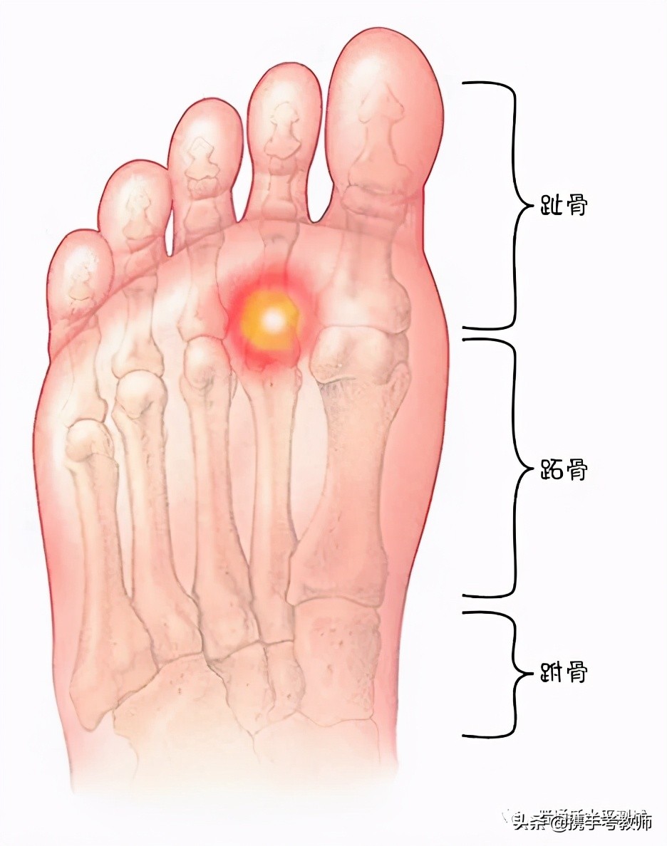 趾骨部位图图片