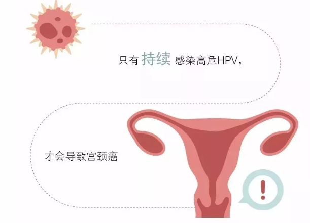 7成以上女性都会感染的HPV病毒，2种情况或致癌变！要提前知道