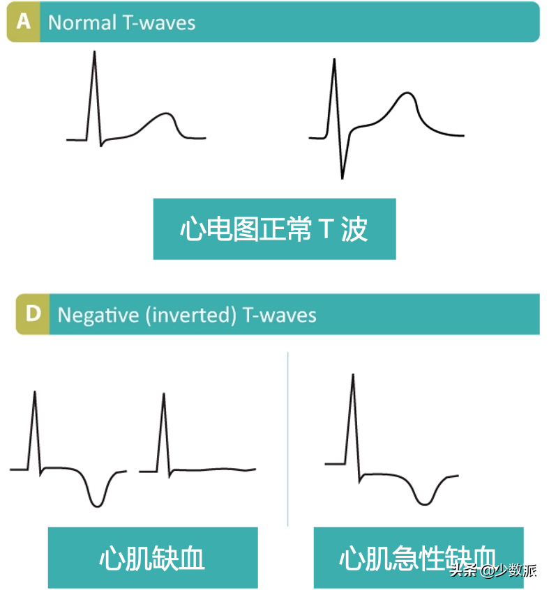 年轻人如何有针对性的体检