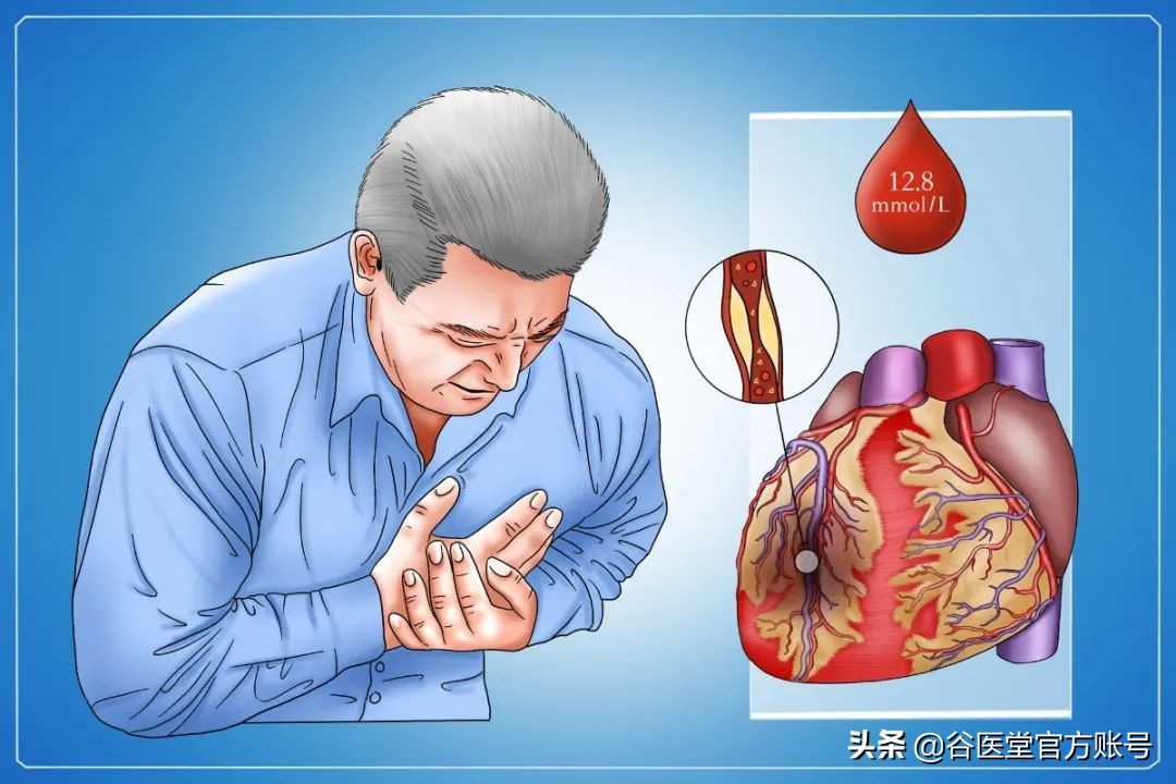 血糖忽高忽低，比高血糖更可怕？血糖波动5大原因揭秘